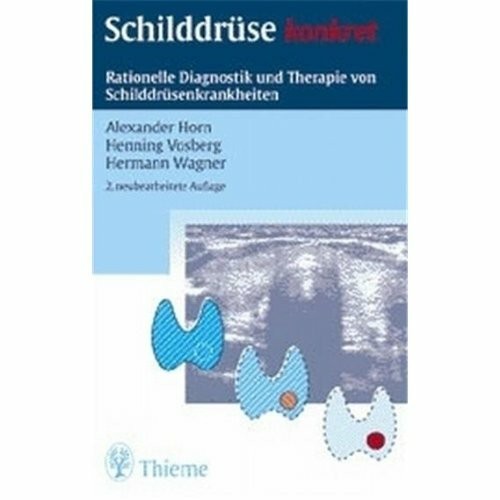 Schilddrüse konkret