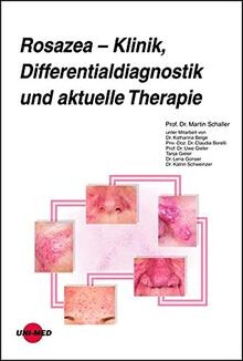 Rosazea klinik - –,